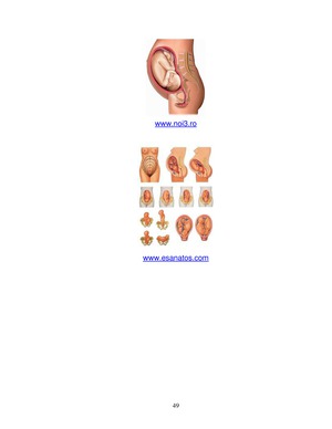 gravida varicioasa